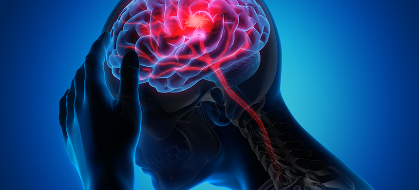 Encefalitis: ¿qué es y cómo prevenirla?